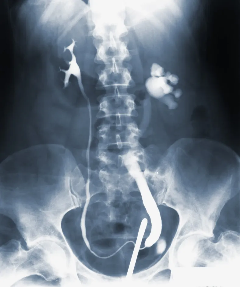 Why My Dog Has Diarrhea But is Acting Fine 3 Dog's Stomach